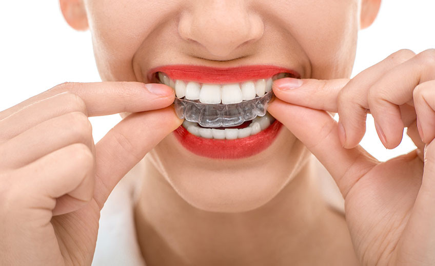 Smile Dental